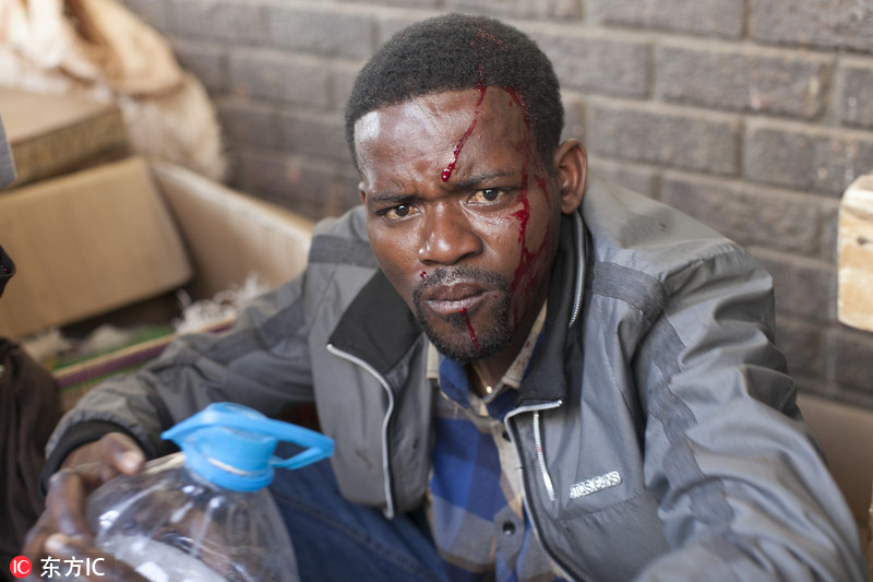 津巴布韦计票结果引发骚乱至少一人被打死多人受伤