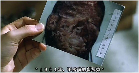 韩国的灰姑娘，因为整容她的脸被弄得面目全非