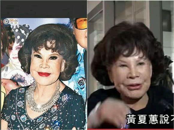 整容失败后的黄夏蕙被胡百全抛弃。随后，黄夏蕙70岁的时候又认识了赛车手潘炳烈。