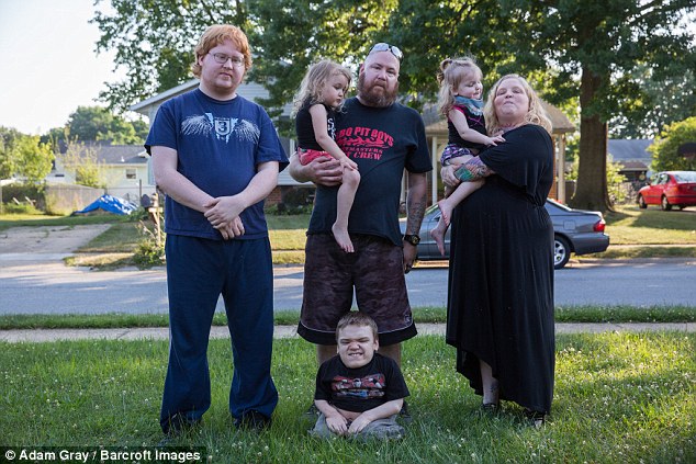 美国夫妻中等身高但4个孩子中3个患侏儒症