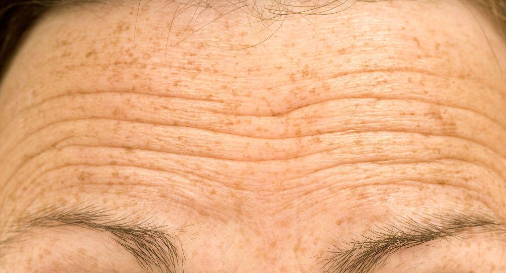 专家:可通过额纹数量预测患病和死亡风险