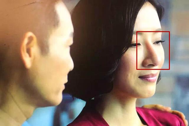 鼻子透光这种bug，很容易就让人联想到，是否鼻子填充了假体？
