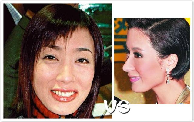 虽然几次三番对着镜头捏鼻梁，自证清白，都不能阻止港媒说她的鼻子“二次发育”。
