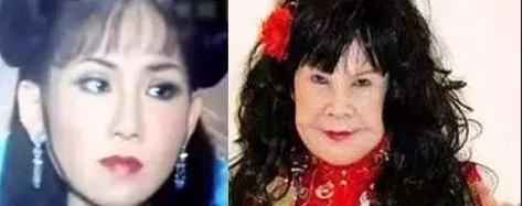 “西门大妈”杨钧钧多年来热衷于整容，可惜这就多年热衷整容的下场呀！