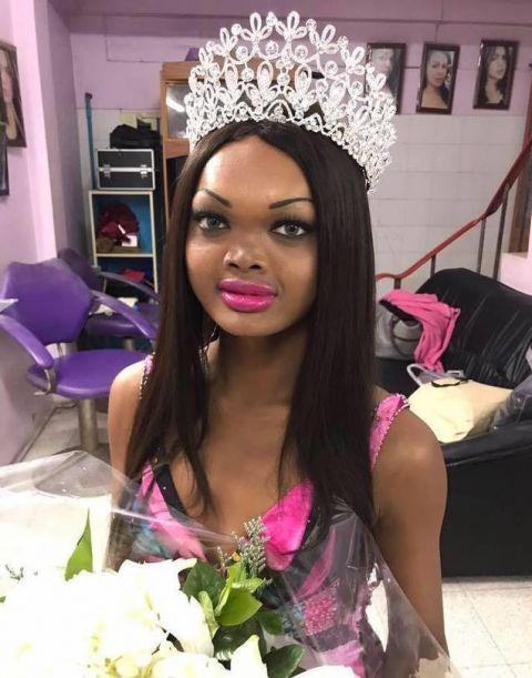 她参加各种选美，拿奖拿到手软，走上国际成为国际知名模特。