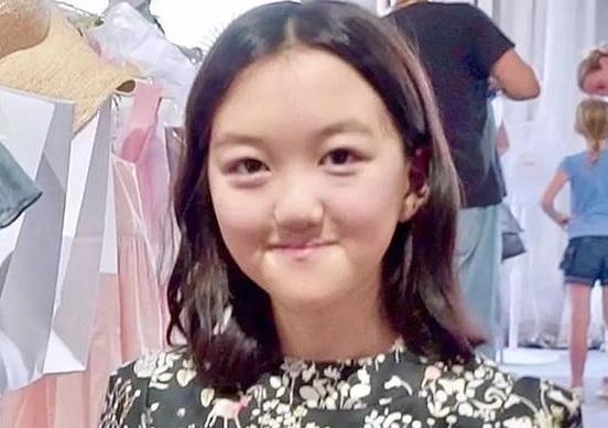 李亚鹏大胆秀出女儿正面照李嫣走出唇裂阴影微笑的样子非常美