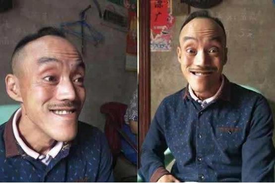 他是现实版光头强,却因长相奇特惨遭抛弃,走红后娶小20岁的美妻