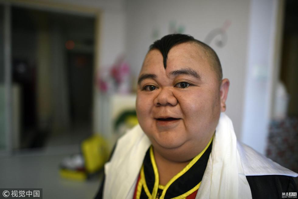 张连红觉得,1米2的张荣能给她安全感.