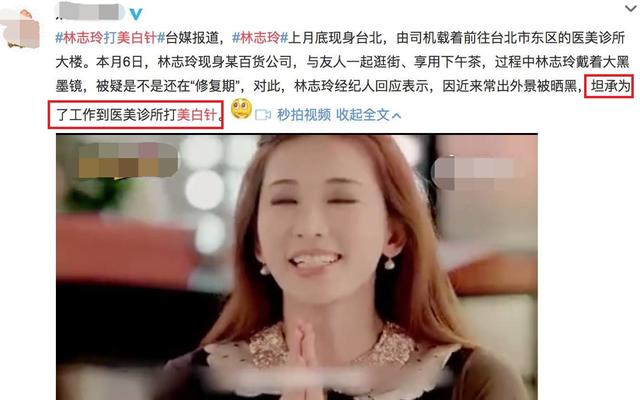 在国内,打美白针是没有获得批准的,所以是存在安全隐患的,因此并不建议大家这么做。