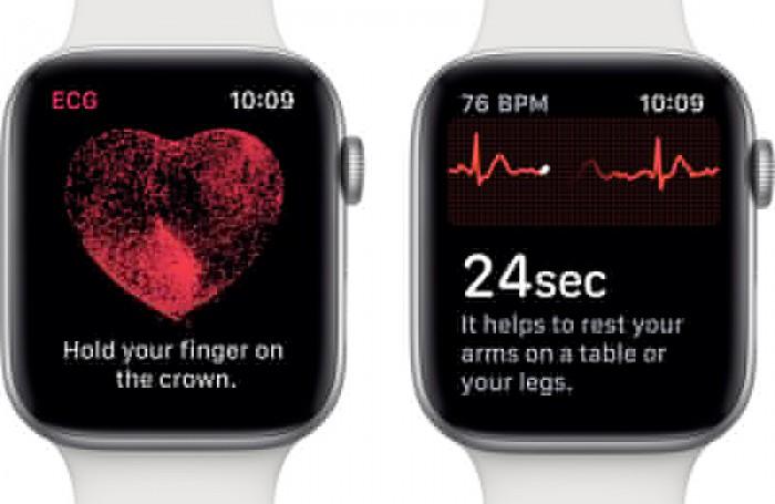 iwatch heart ekg