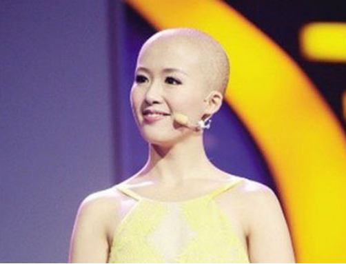 网红"光头女孩"火了,戴20多年假发摘下那一刻,全场男生都呆了