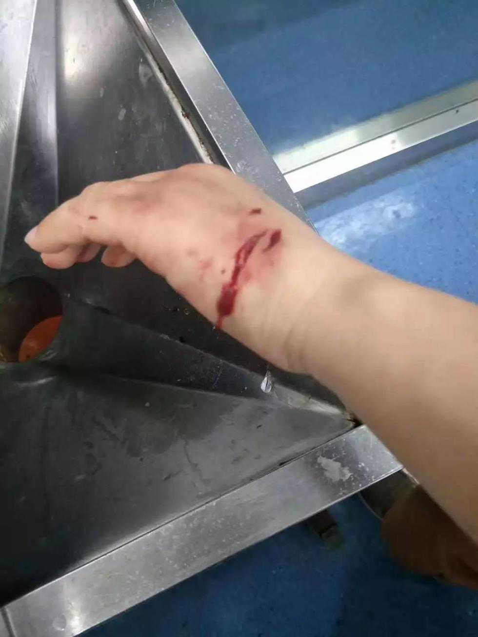 林女士昨晚在南塘一组团被咬伤。
