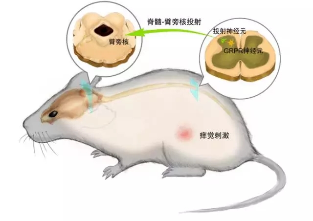 研究发现控制痒的神经元挠不挠它说了算