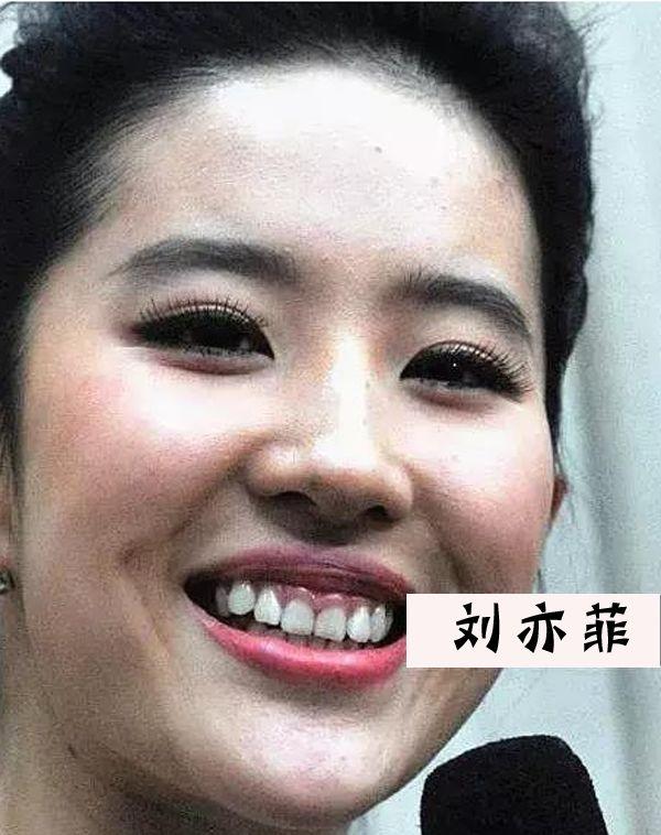 第三个就是周迅,周迅皮肤不好在娱乐圈都有传闻。都是从这一张图开始的。