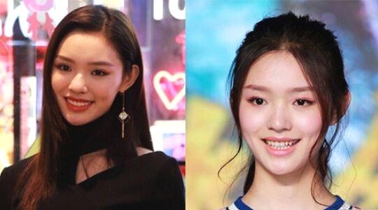 整牙对大部分人来说，其实是一个加分项，但是对于她来说，会把自己的特色整没。