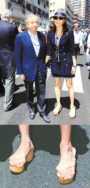 杨紫琼的脚比宋茜更严重,脚的拇指已经完全歪了。