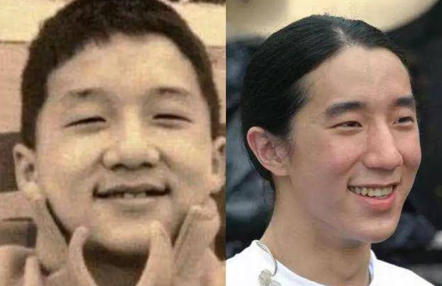 【他们也是双眼皮的获利者】