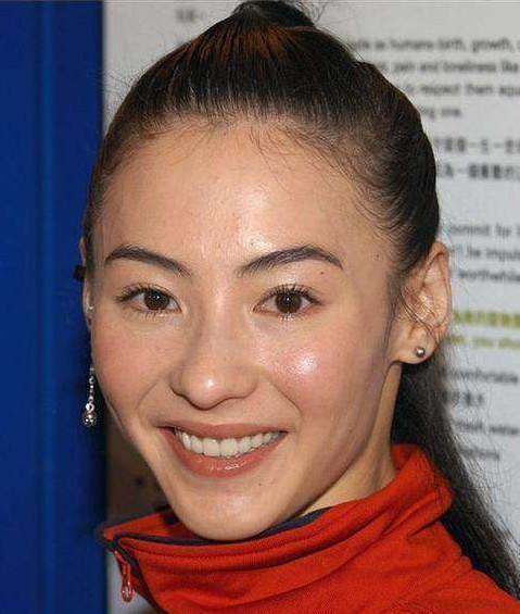 张柏芝。曾经的女神,脸上的斑点痘痘可都不少。