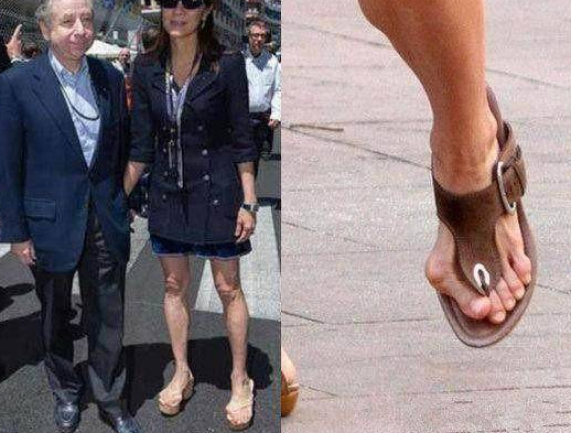 其实因为现在很多女孩子都喜欢穿高跟鞋的缘故，所以脚趾大多都会有变形，明星也不例外~