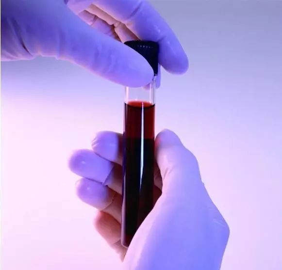 的静脉血;静脉血回流心脏,通过呼吸加氧后,就会变回鲜红色的动脉血