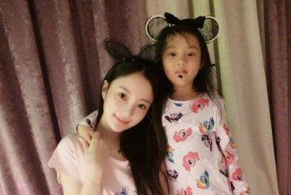 随了父母,特别是小时候,毕竟"女大十八变",曾因女儿长得丑被质疑整容