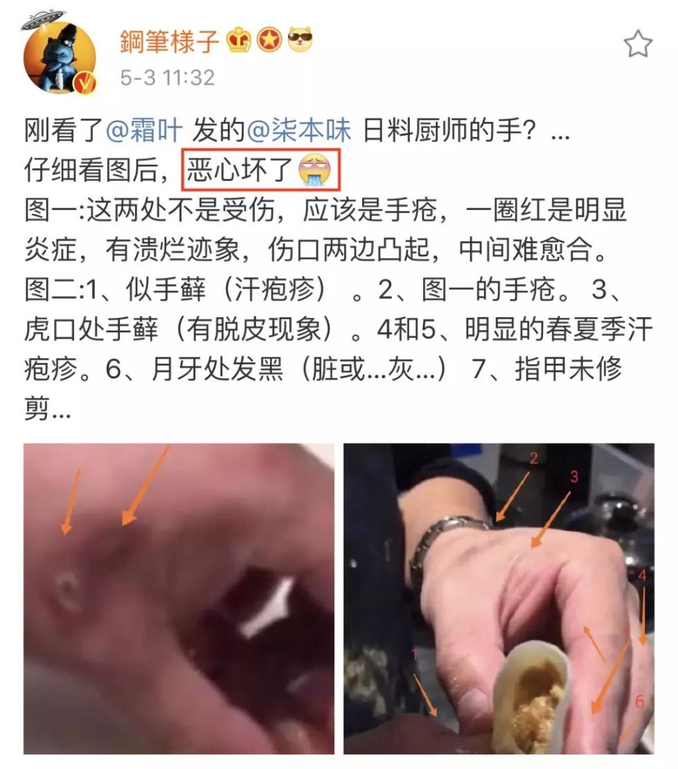 厨师手上带"疮"操作!高端网红日料店火一天就停业!网友恶心坏了