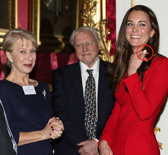 2014年2月，戏剧艺术招待会上的凯特王妃左手拇指缠着创可贴。(图源：每日邮报)