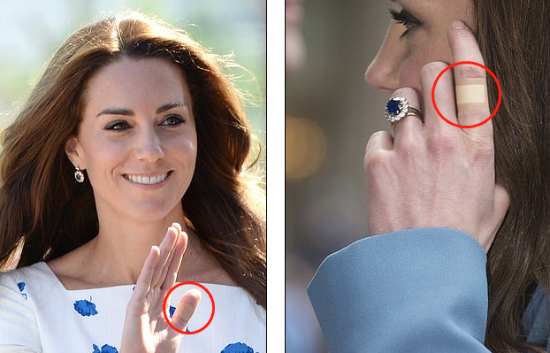 2016年2月，凯特王妃被拍到左手食指和右手拇指缠着创可贴。(图源：每日邮报)