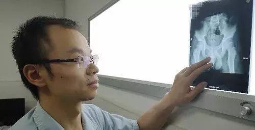 由于针很细很长,容易移位,会造成其他脏器的损害,因此必须尽快取出。