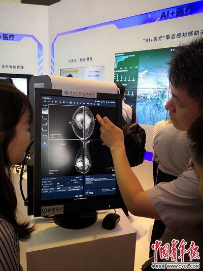 医疗“黑科技”会改变哪些看病体验