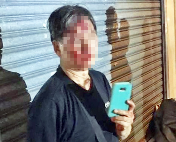 香港一六旬男子疑因清理“连侬墙”被打受伤(港媒截图)
