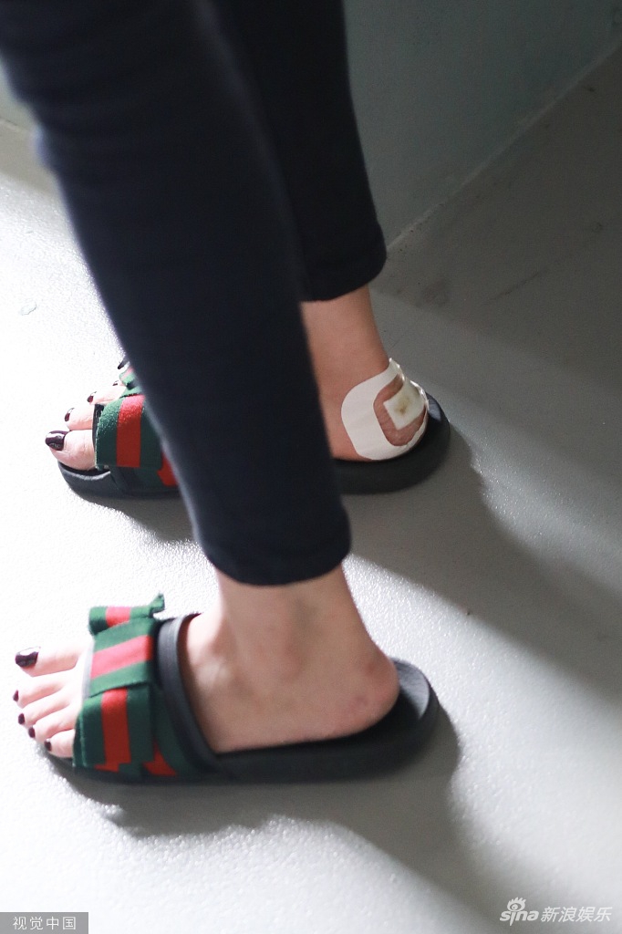 颖儿脚后跟受伤大冷天光脚穿拖鞋 美腿纤细好身材吸睛