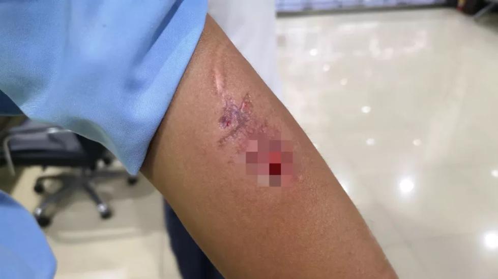 男子闹市发疯,在交警胳膊上狠咬一口!