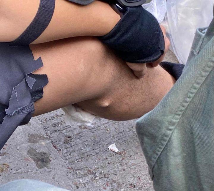 警察传媒联络队一队员被箭射中小腿，图自香港警察脸书