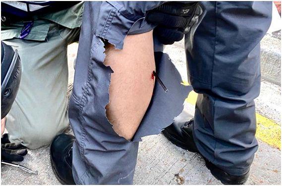 警察传媒联络队(FMLC)队员中箭，图自香港警察脸书