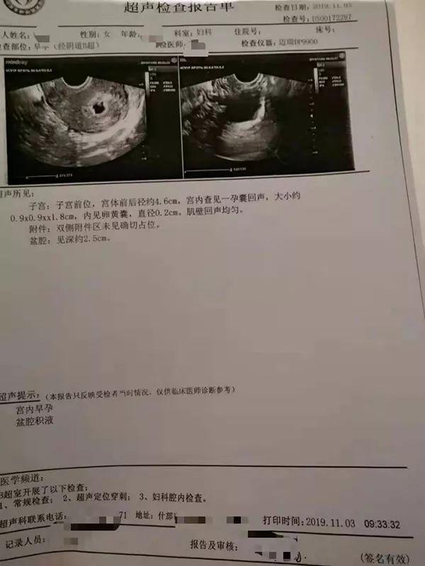 男子做完绝育手术4个月后老婆竟然怀孕了