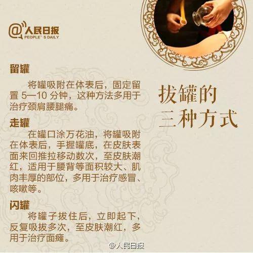 女演员拔罐被烧伤画面触目惊心这些误区不可不知