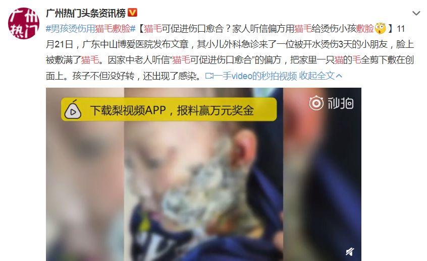 为了清肝明目，她生死挣扎72小时！这些偏方都不靠谱