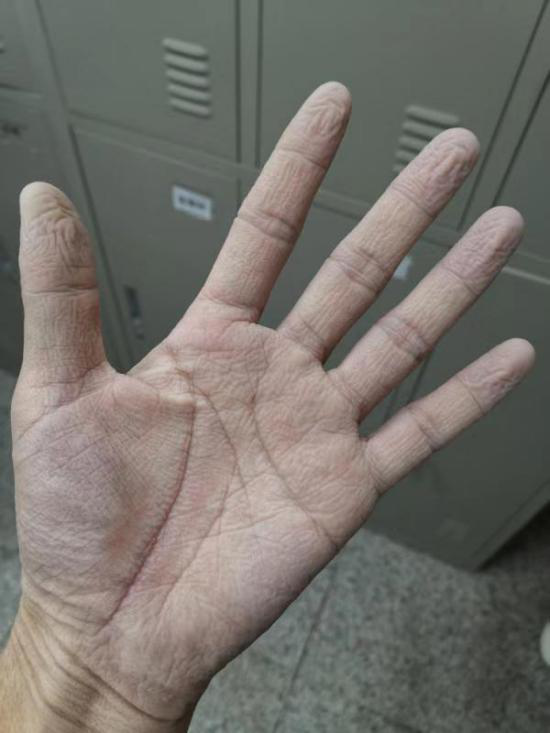 这双满是皱褶的手为何获得数万点赞