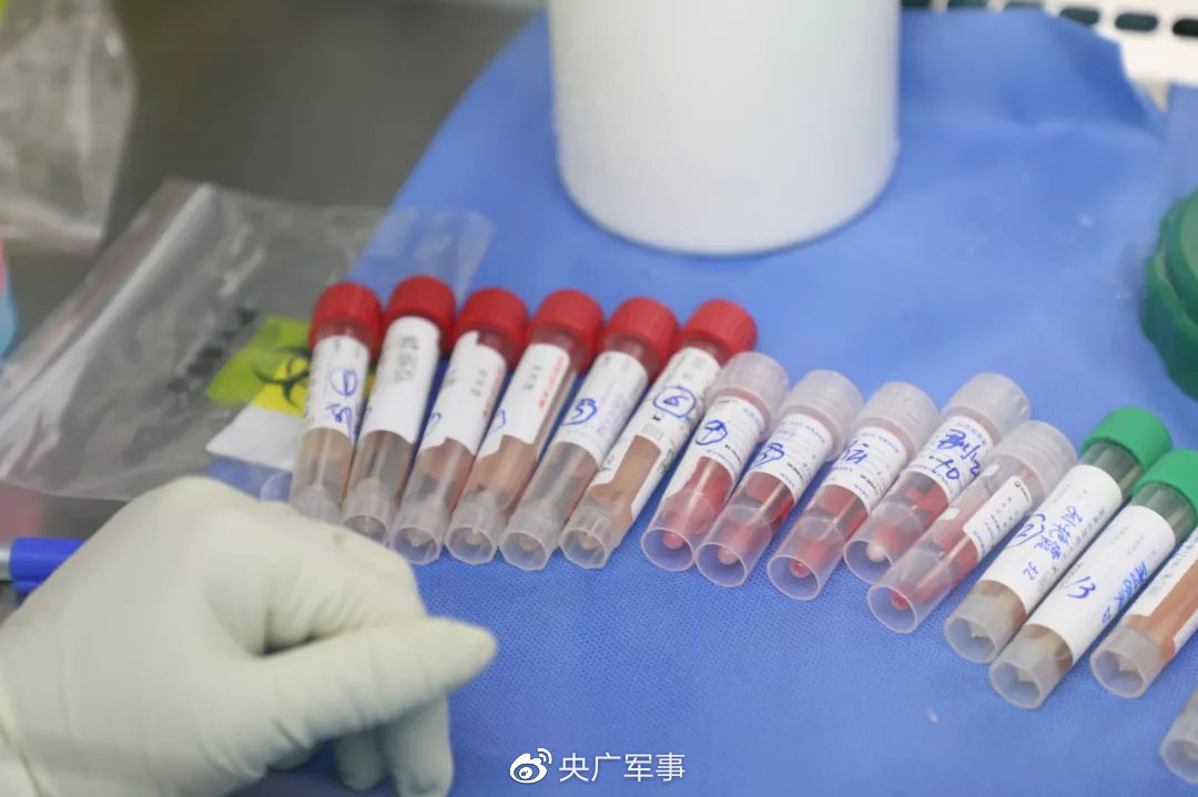 待检的样本（资料图）