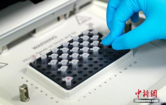 国资委新冠肺炎疫苗研发正紧锣密鼓推进