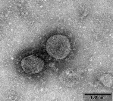 新型冠状病毒电镜图