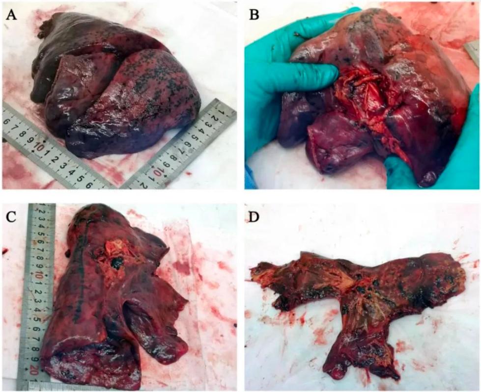 研究团队在p3实验室对肺病理组织进行了固定,脱水,石蜡包埋,组织切片