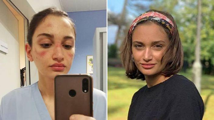 意大利护士阿莱西亚⋅博纳里（图源：雅虎新闻网）